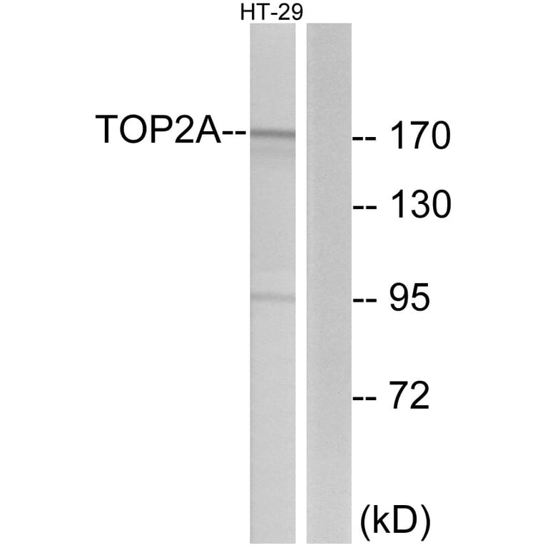 Western Blot - Anti-TOP2A Antibody (C10345) - Antibodies.com