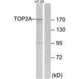 Western Blot - Anti-TOP2A Antibody (C10345) - Antibodies.com