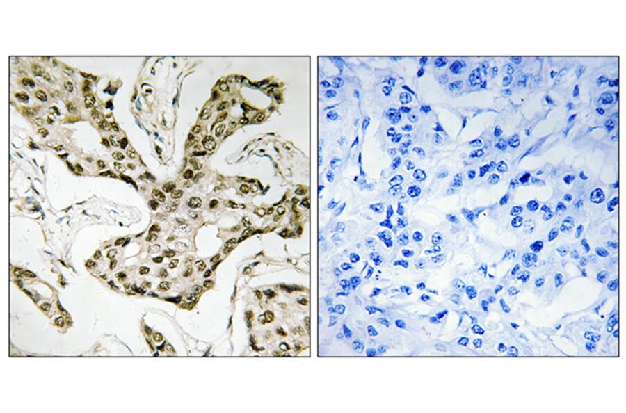 Immunohistochemistry - Anti-TOP2A Antibody (C10345) - Antibodies.com