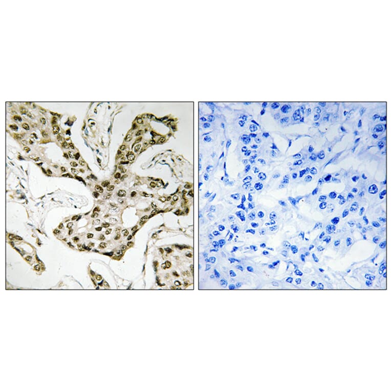 Immunohistochemistry - Anti-TOP2A Antibody (C10345) - Antibodies.com