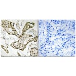 Immunohistochemistry - Anti-TOP2A Antibody (C10345) - Antibodies.com
