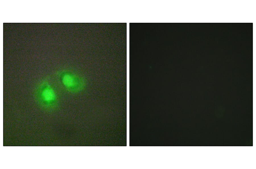 Immunofluorescence - Anti-TOP2A Antibody (C10345) - Antibodies.com