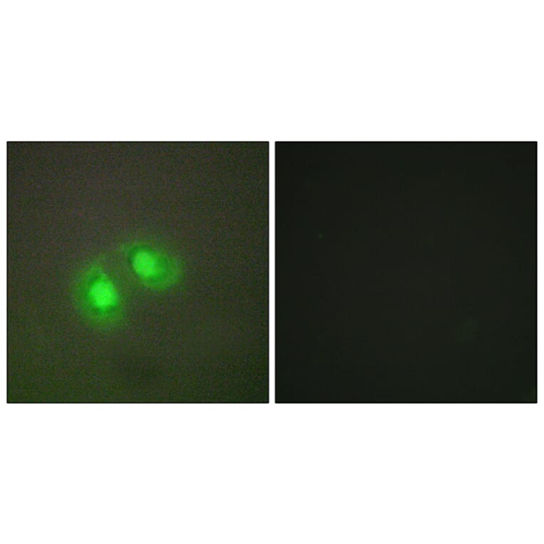 Immunofluorescence - Anti-TOP2A Antibody (C10345) - Antibodies.com