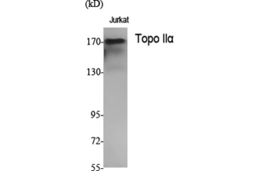 Western Blot - Anti-TOP2A Antibody (C10345) - Antibodies.com