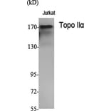Western Blot - Anti-TOP2A Antibody (C10345) - Antibodies.com