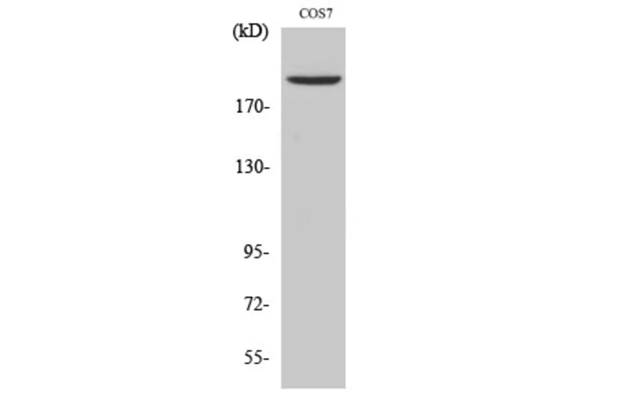 Western Blot - Anti-TOP2A Antibody (C10345) - Antibodies.com