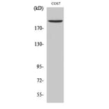 Western Blot - Anti-TOP2A Antibody (C10345) - Antibodies.com