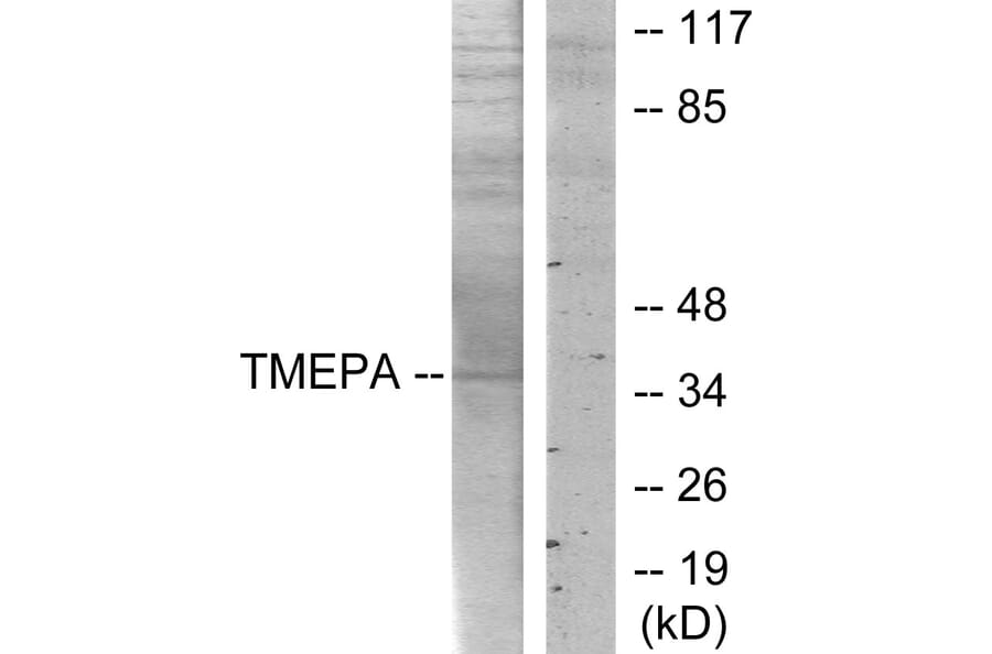 Western Blot - Anti-TMEPA Antibody (C11467) - Antibodies.com
