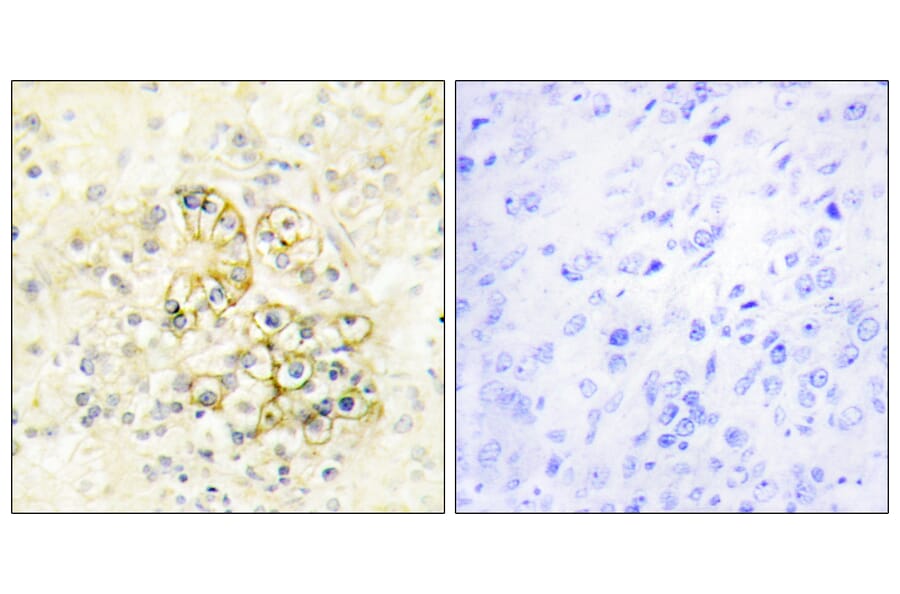 Immunohistochemistry - Anti-TMEPA Antibody (C11467) - Antibodies.com