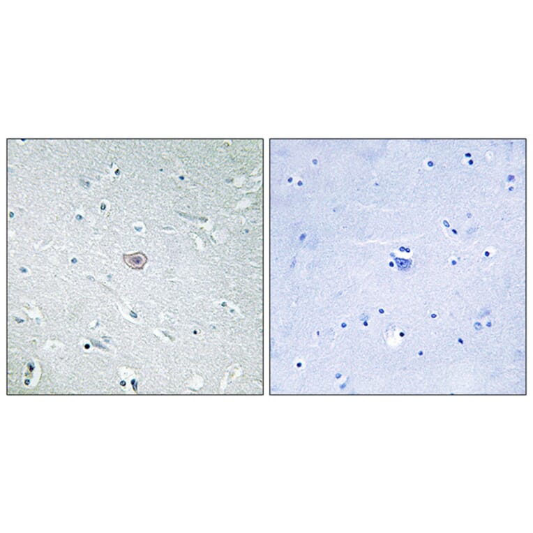 Immunohistochemistry - Anti-PE2R3 Antibody (G098) - Antibodies.com