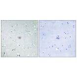 Immunohistochemistry - Anti-PE2R3 Antibody (G098) - Antibodies.com