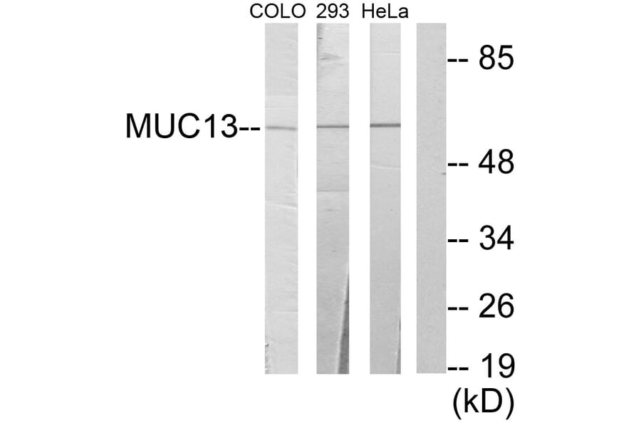 Western Blot - Anti-MUC13 Antibody (C11690) - Antibodies.com