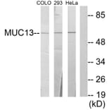 Western Blot - Anti-MUC13 Antibody (C11690) - Antibodies.com