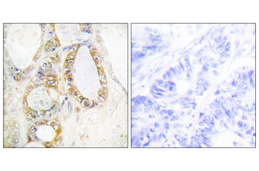 Immunohistochemistry - Anti-MUC13 Antibody (C11690) - Antibodies.com