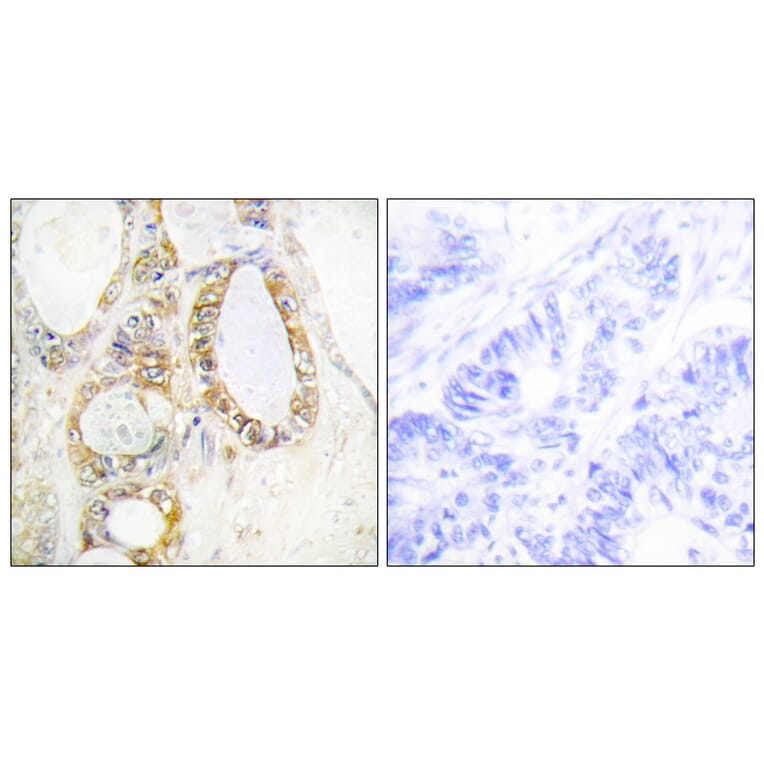 Immunohistochemistry - Anti-MUC13 Antibody (C11690) - Antibodies.com