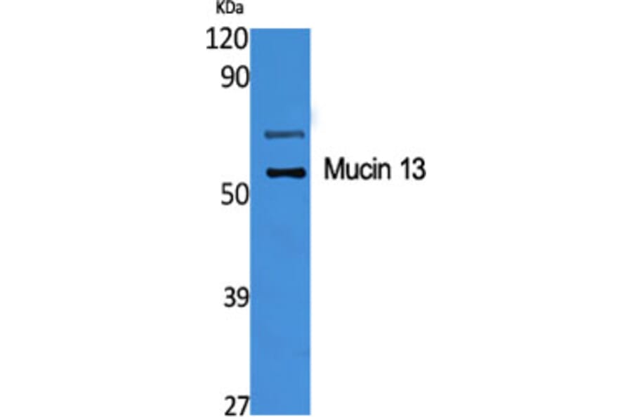Western Blot - Anti-MUC13 Antibody (C11690) - Antibodies.com