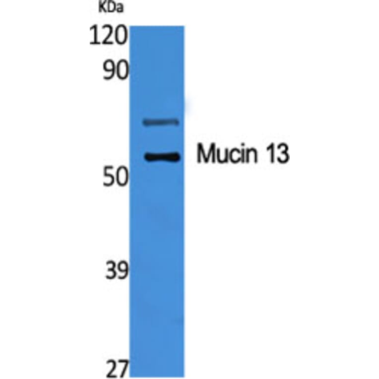 Western Blot - Anti-MUC13 Antibody (C11690) - Antibodies.com