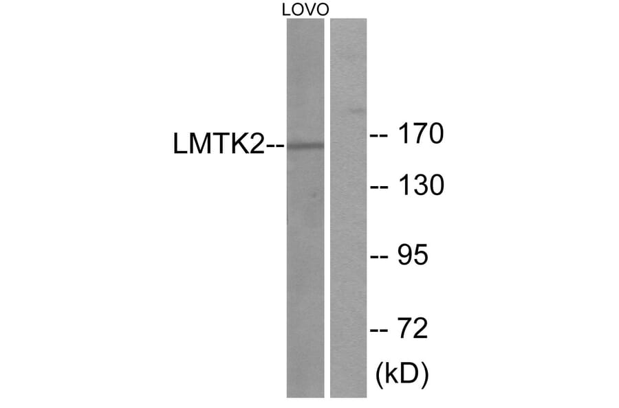 Western Blot - Anti-LMTK2 Antibody (C11315) - Antibodies.com