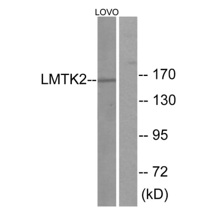 Western Blot - Anti-LMTK2 Antibody (C11315) - Antibodies.com