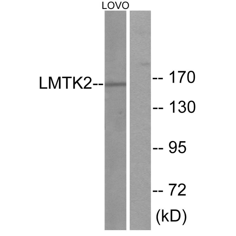 Western Blot - Anti-LMTK2 Antibody (C11315) - Antibodies.com