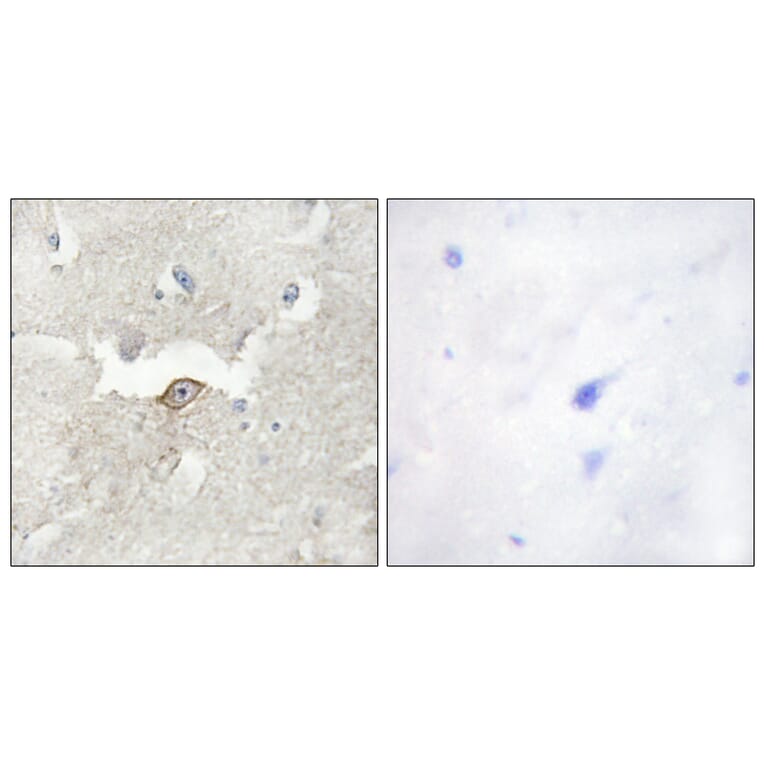Immunohistochemistry - Anti-LMTK2 Antibody (C11315) - Antibodies.com