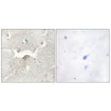 Immunohistochemistry - Anti-LMTK2 Antibody (C11315) - Antibodies.com