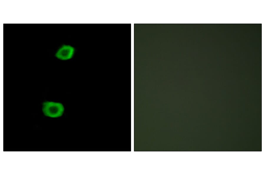 Immunofluorescence - Anti-LMTK2 Antibody (C11315) - Antibodies.com