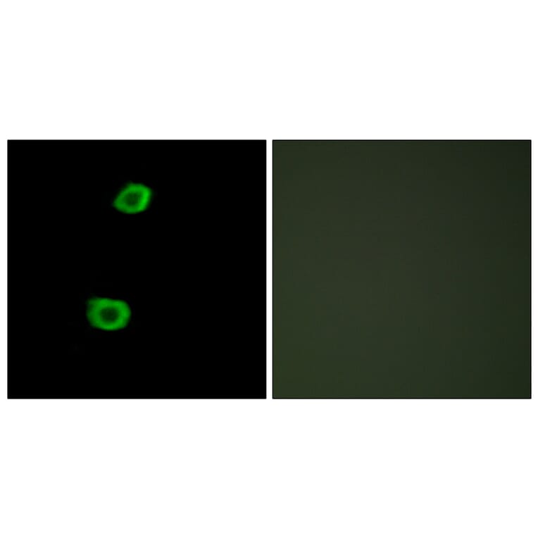 Immunofluorescence - Anti-LMTK2 Antibody (C11315) - Antibodies.com