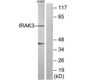 Western Blot - Anti-IRAK3 Antibody (C11980) - Antibodies.com