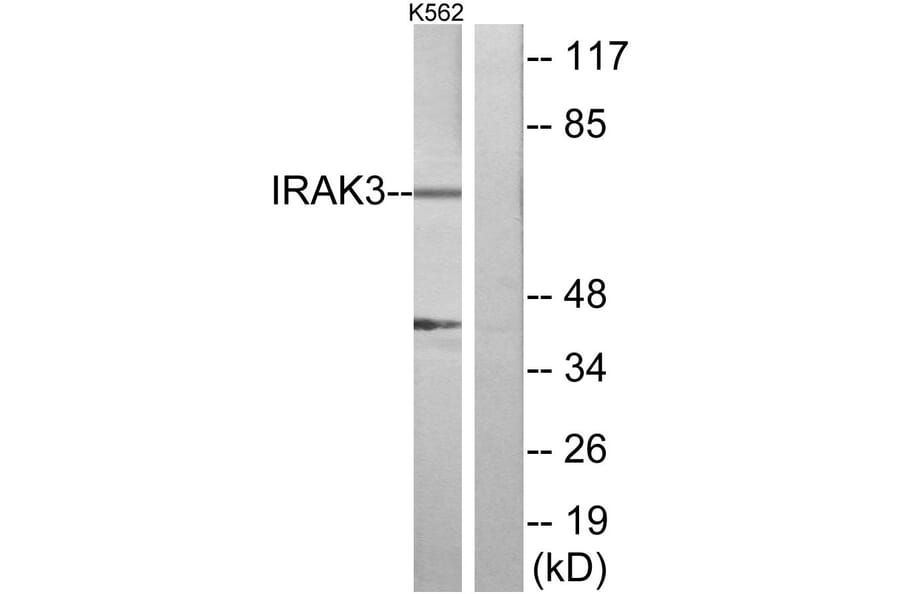 Western Blot - Anti-IRAK3 Antibody (C11980) - Antibodies.com