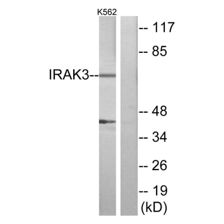 Western Blot - Anti-IRAK3 Antibody (C11980) - Antibodies.com