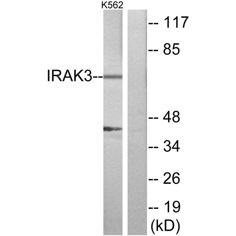 Western Blot - Anti-IRAK3 Antibody (C11980) - Antibodies.com