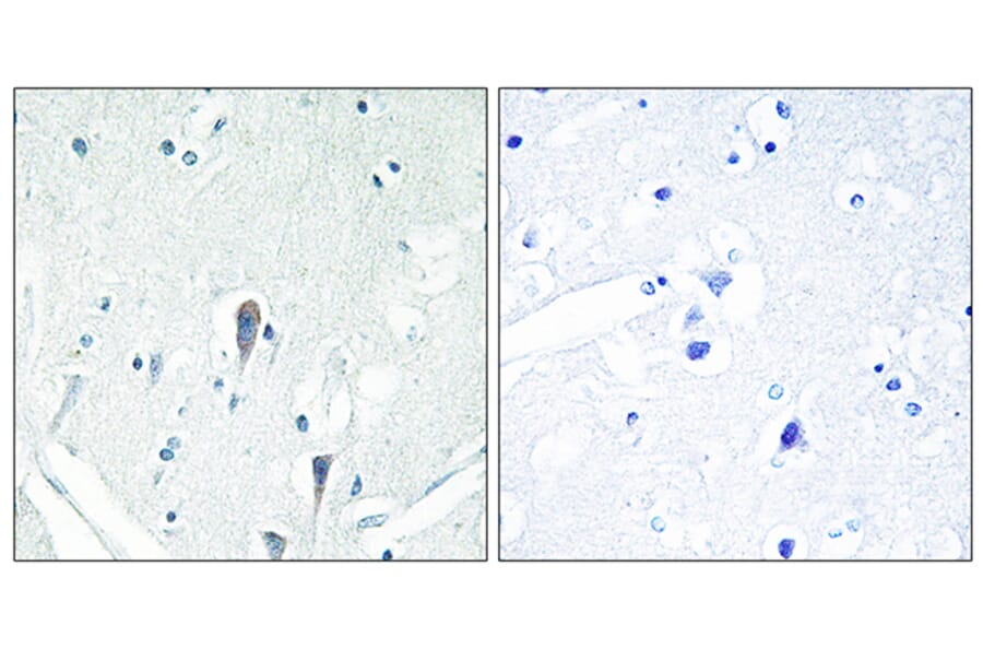 Immunohistochemistry - Anti-IRAK3 Antibody (C11980) - Antibodies.com