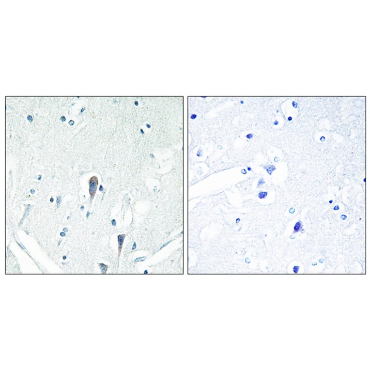 Immunohistochemistry - Anti-IRAK3 Antibody (C11980) - Antibodies.com