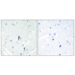 Immunohistochemistry - Anti-IRAK3 Antibody (C11980) - Antibodies.com