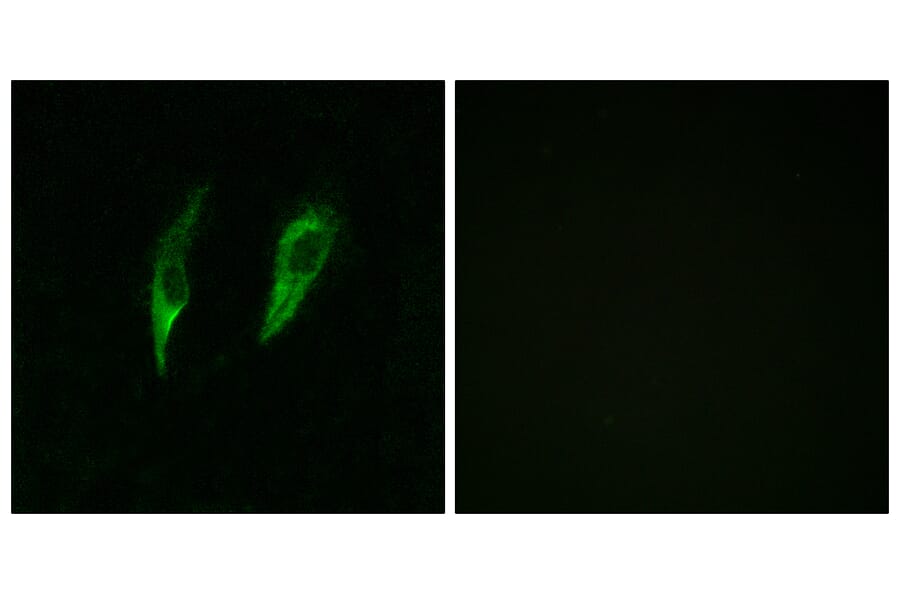 Immunofluorescence - Anti-IRAK3 Antibody (C11980) - Antibodies.com
