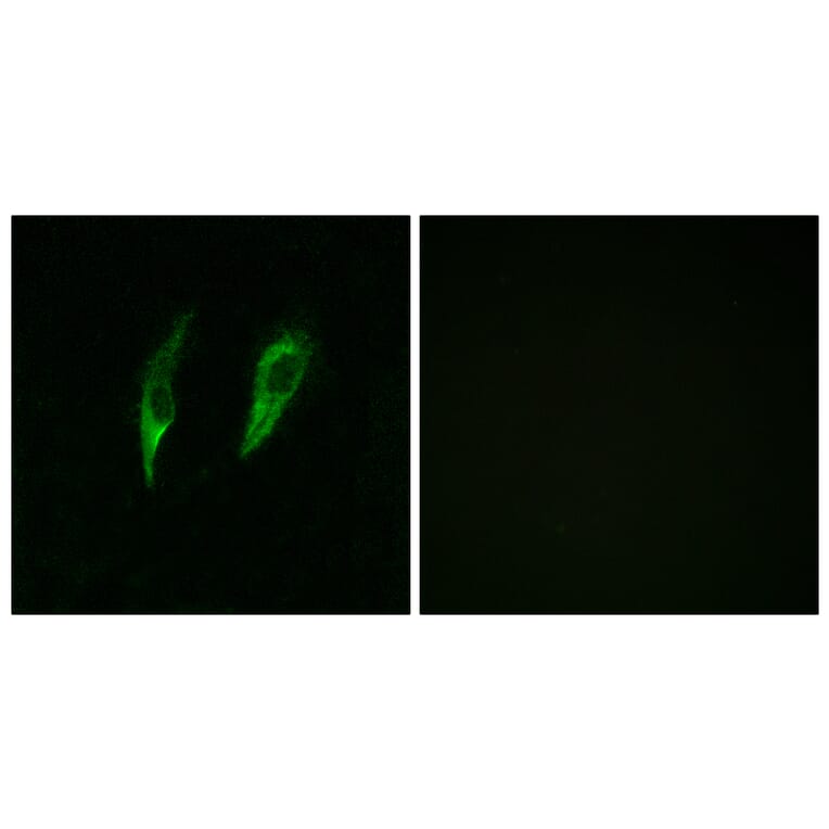 Immunofluorescence - Anti-IRAK3 Antibody (C11980) - Antibodies.com