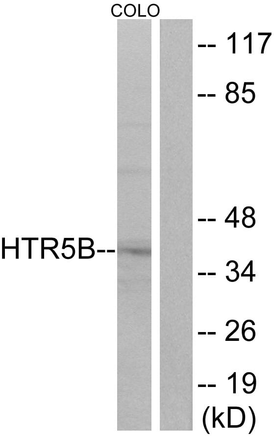 Western blot analysis of lysates from COLO cells using Anti-HTR5B Antibody. The right hand lane represents a negative control, where the antibody is blocked by the immunising peptide.