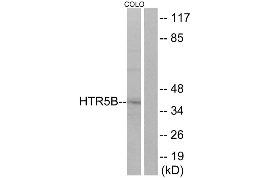 Western Blot - Anti-HTR5B Antibody (G016) - Antibodies.com