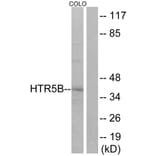 Western Blot - Anti-HTR5B Antibody (G016) - Antibodies.com
