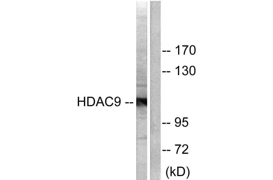 Western Blot - Anti-HDAC9 Antibody (C0228) - Antibodies.com