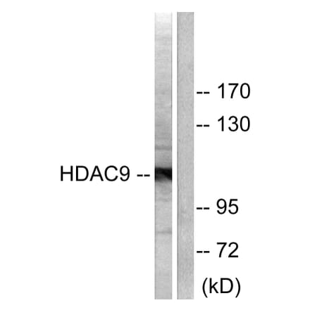 Western Blot - Anti-HDAC9 Antibody (C0228) - Antibodies.com