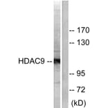 Western Blot - Anti-HDAC9 Antibody (C0228) - Antibodies.com