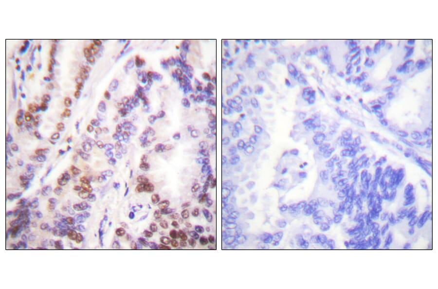 Immunohistochemistry - Anti-HDAC9 Antibody (C0228) - Antibodies.com