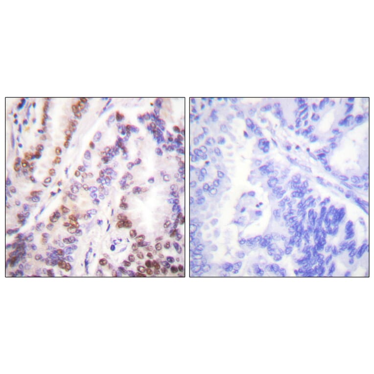 Immunohistochemistry - Anti-HDAC9 Antibody (C0228) - Antibodies.com