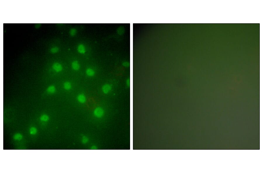 Immunofluorescence - Anti-HDAC9 Antibody (C0228) - Antibodies.com