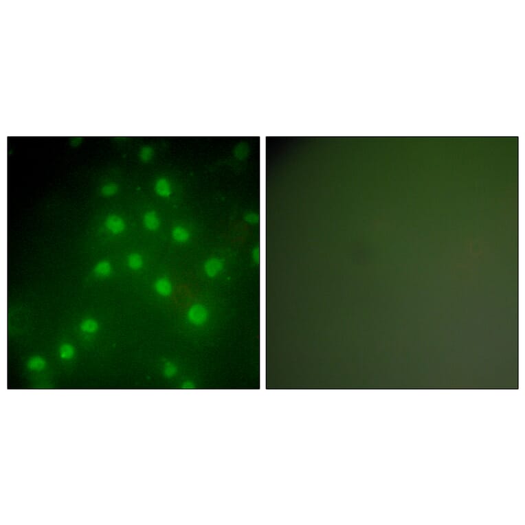 Immunofluorescence - Anti-HDAC9 Antibody (C0228) - Antibodies.com