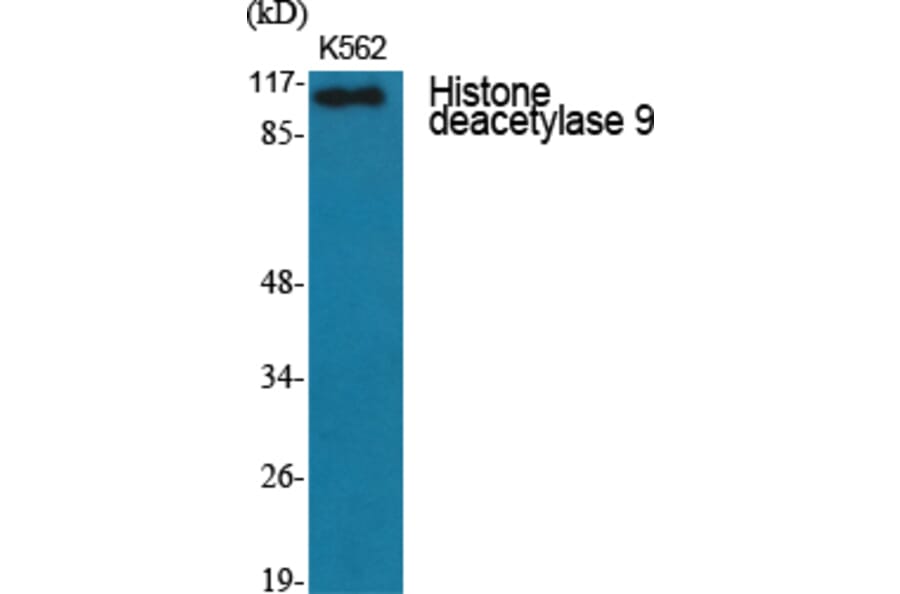 Western Blot - Anti-HDAC9 Antibody (C0228) - Antibodies.com