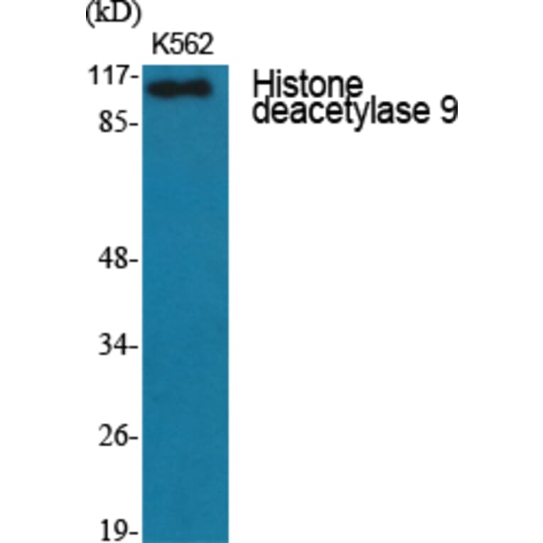 Western Blot - Anti-HDAC9 Antibody (C0228) - Antibodies.com