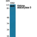 Western Blot - Anti-HDAC9 Antibody (C0228) - Antibodies.com